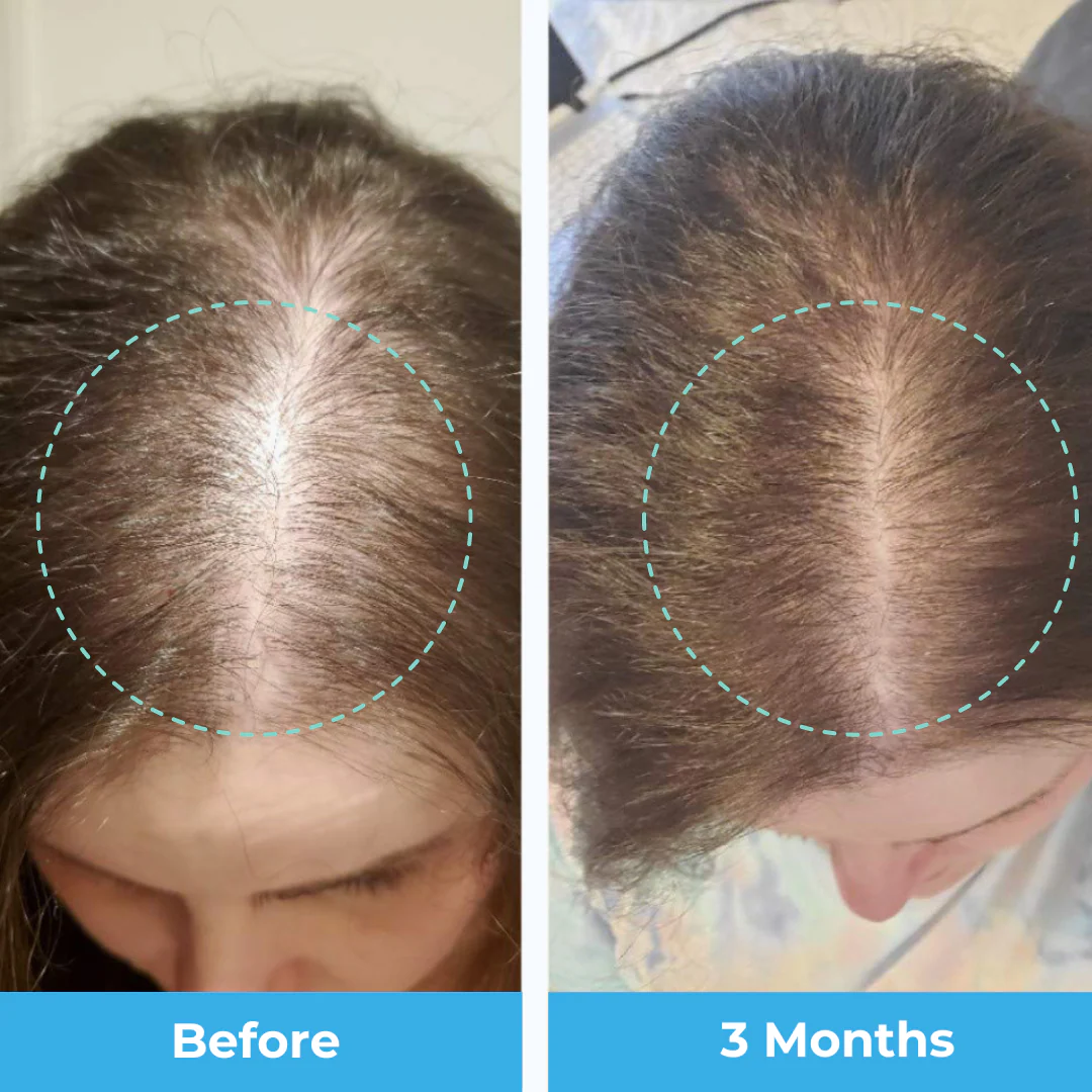 Postpartum Hair Vitamins - 3 Month Supply - Image 4